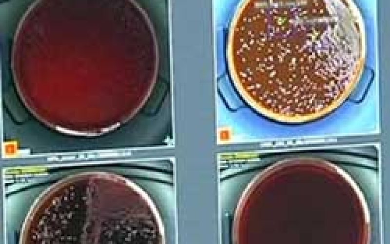 Africa’s first automated microbiology lab unveiled in Durban
